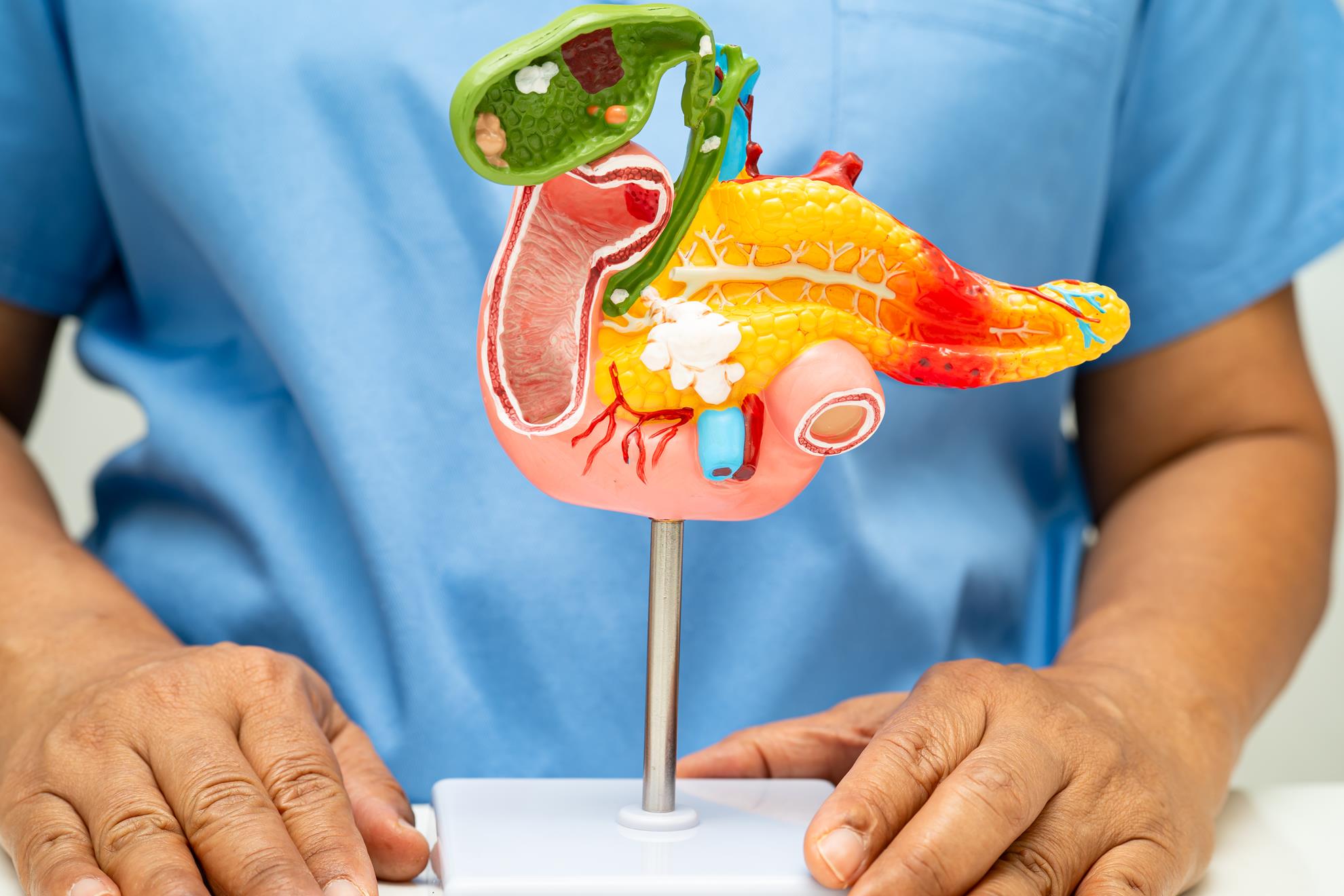 pancreatite