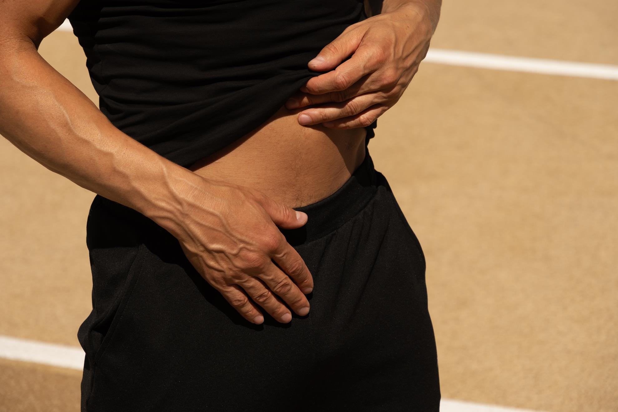 hernia